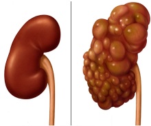 kidney disease | Dierenkliniek